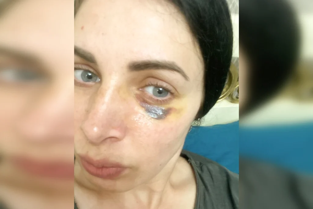 Селфи Марии Смелой, которое она отправила координаторке правозащитного проекта «Кавказ без матери» Лидии Михальченко.