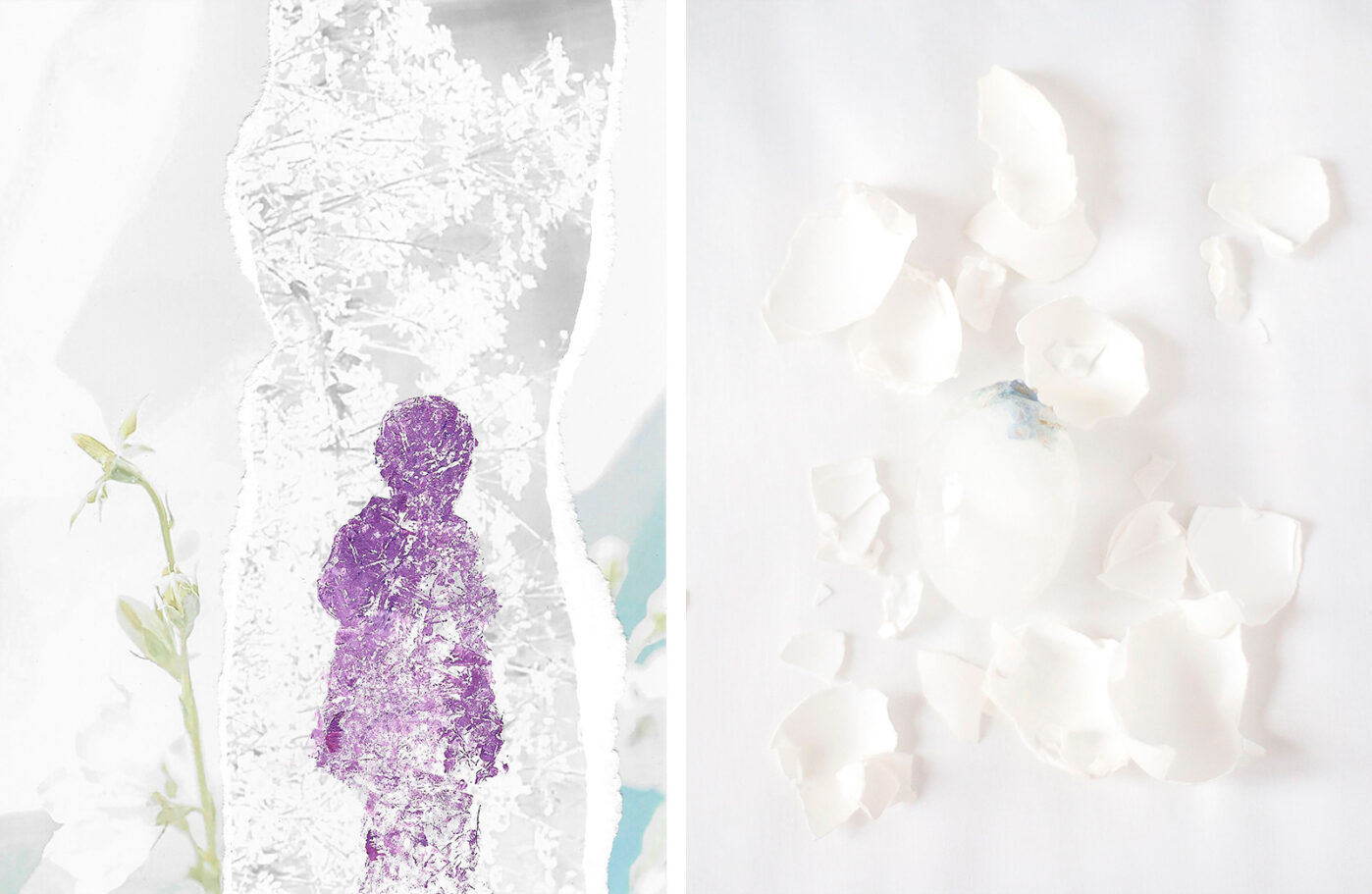 Женщинам с&nbsp;поликистозом яичников обычно дают 6-12 месяцев на&nbsp;попытки забеременеть естественным путём, а&nbsp;затем предлагают ЭКО