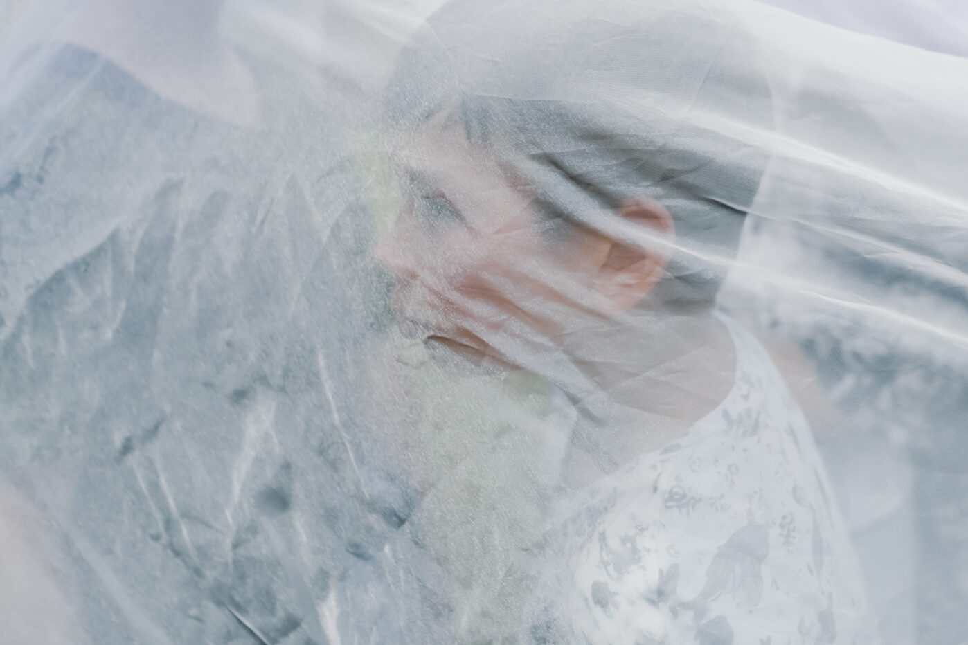 В&nbsp;Ярославской области работает единственный в&nbsp;России лагерь для детей с&nbsp;ожогами. Его организовал фонд «Детская больница» при больнице имени Сперанского