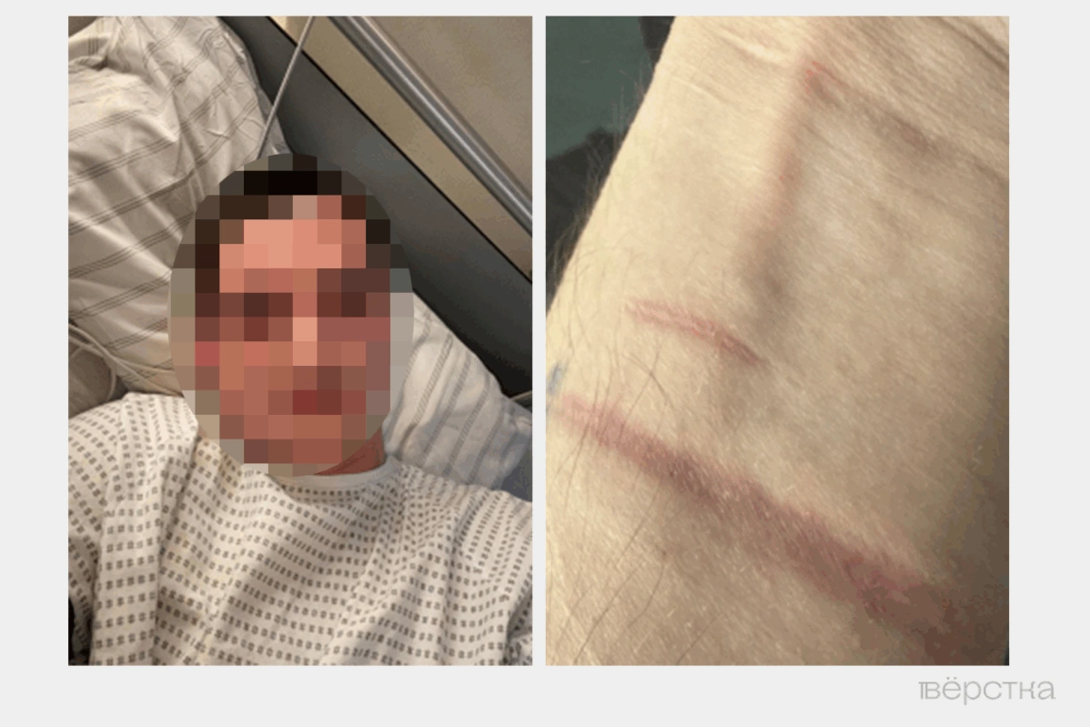 В&nbsp;соответствии с&nbsp;новым расписанием болезней психические заболевания&nbsp;— не&nbsp;повод к&nbsp;признанию негодными. Таких людей отправляют на&nbsp;фронт