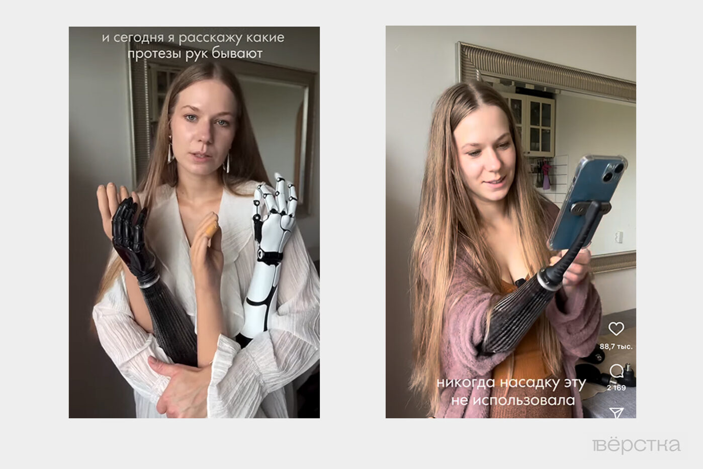 Качественные протезы рук позволяют повторять основные движения, но&nbsp;Социальный фонд может отказать в&nbsp;их&nbsp;покупке&nbsp;— стоят такие протезы слишком дорого